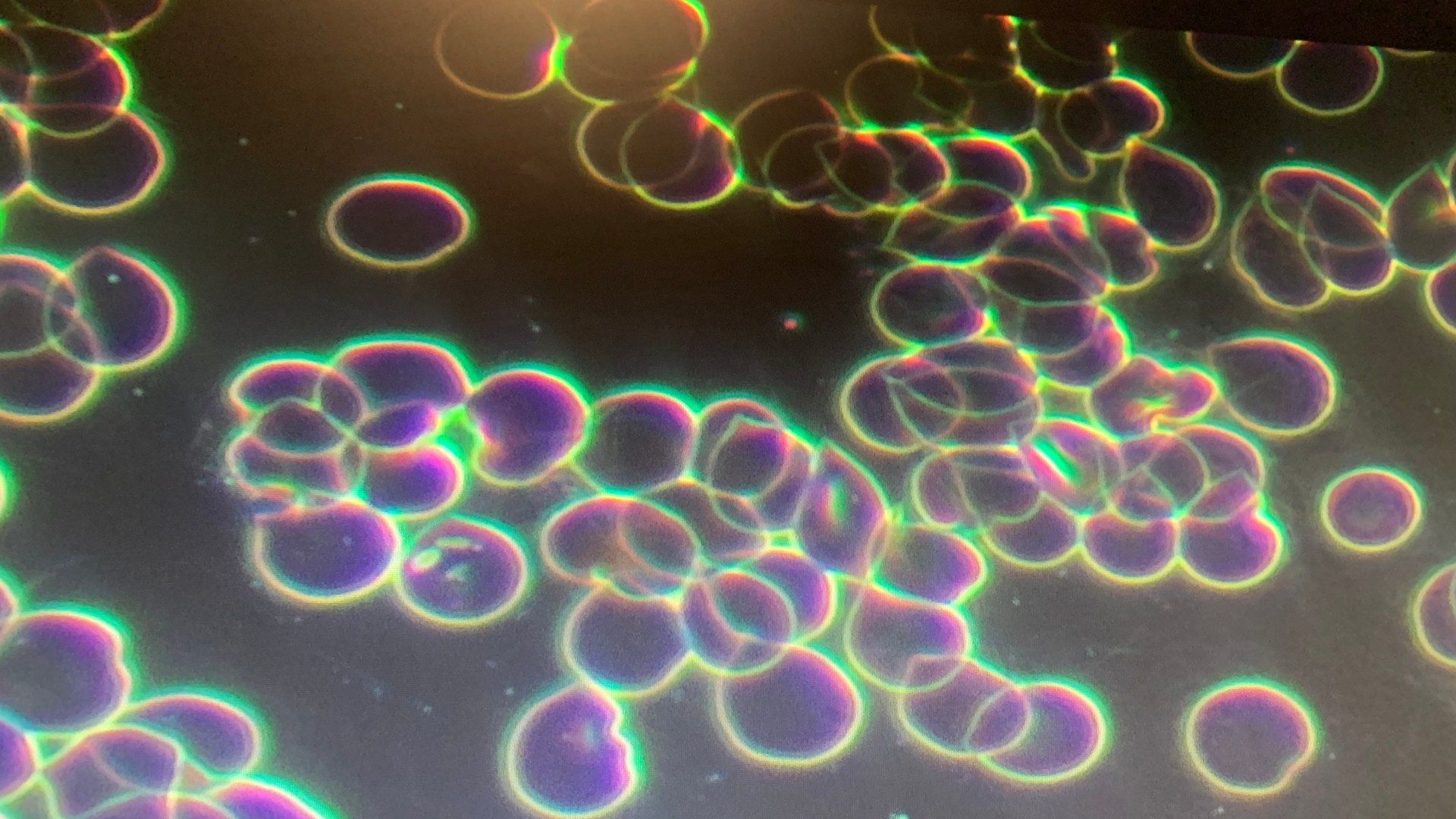 Live Blood Cell Analysis – Graceful Refinement